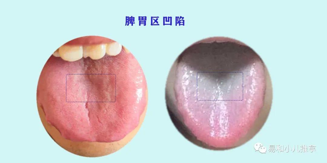 白话舌相